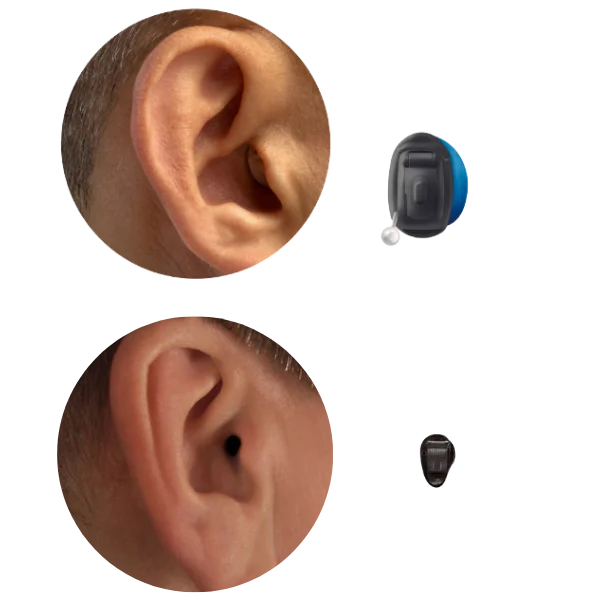 Invisible or Completely in Canal hearing aid