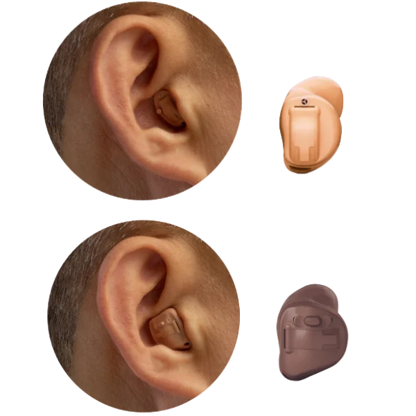 In the Canal or In the Ear hearing aid